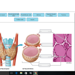 Thyroid gland histology anatomy tissue microscope endocrine microscopic biology tiroides histologia labeled microscopio follicular parafollicular proteinatlas lamina glands epithelium odwiedź