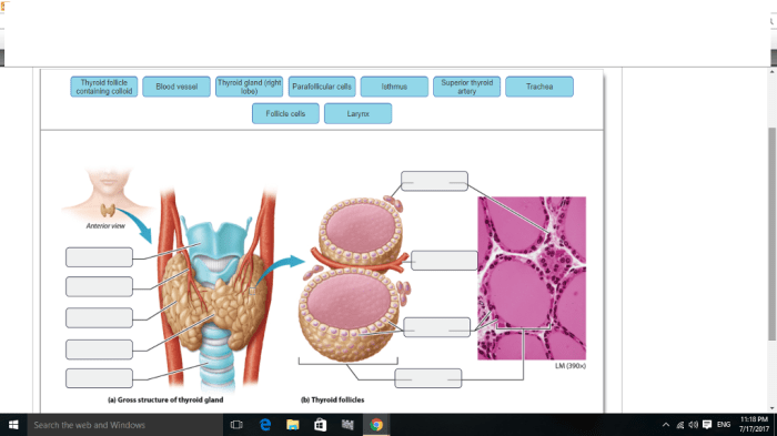 Thyroid gland histology anatomy tissue microscope endocrine microscopic biology tiroides histologia labeled microscopio follicular parafollicular proteinatlas lamina glands epithelium odwiedź